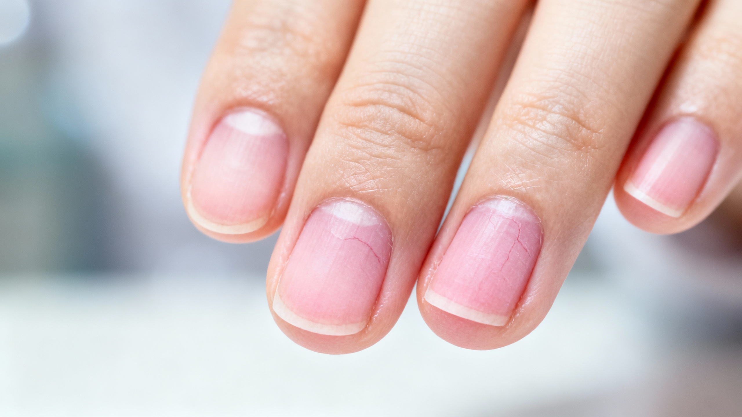 Your trusted guide to nail health